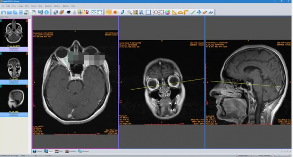 u533bu5b66u5f71u50cfu6d4fu89c8u5668Sante DICOM Viewer Pro 